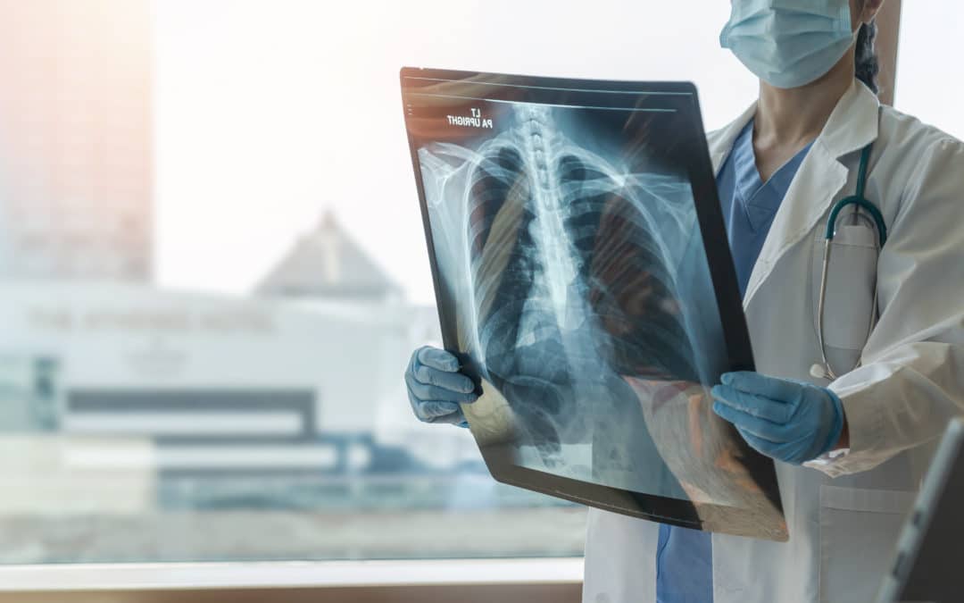 Understanding the Four Types of Mesothelioma: What You Should Know